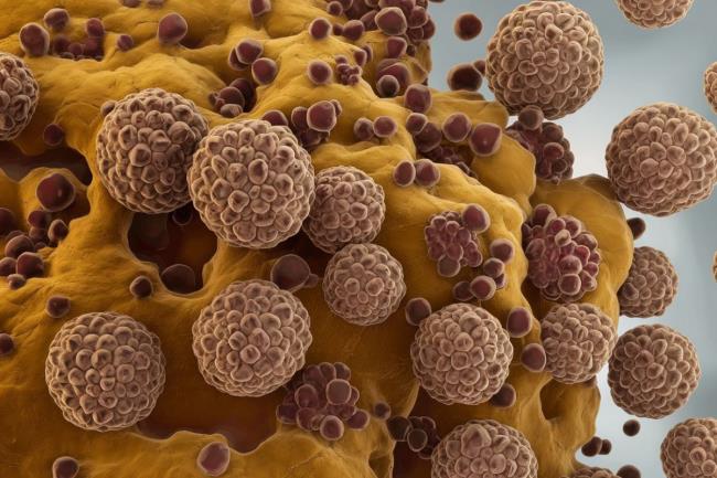 50-facts-a<em></em>bout-coccidioidomycosis
