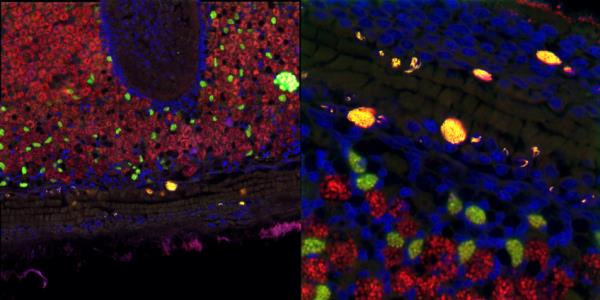 Microscopy image of tissues from a deep-sea mussel showing the intranuclear parasite Candidatus Endo<em></em>nucleobacter in yellow, and the beneficial symbiotic bacteria in green and red. Cell nuclei are stained blue. The right panel is a zoom-in of the white square in the left panel. 