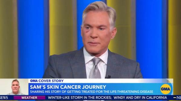 Sam Champion talking a<em></em>bout his cancer on Friday's "GMA." 