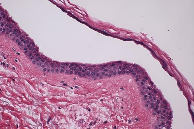 50-facts-a<em></em>bout-pemphigus-foliaceus